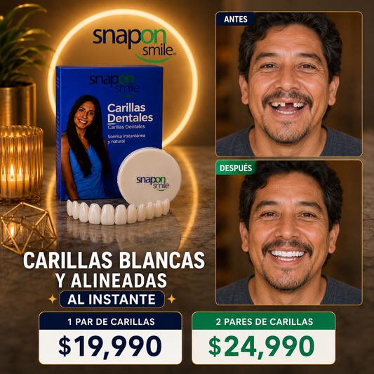 Carillas Snap On Smile Dientes